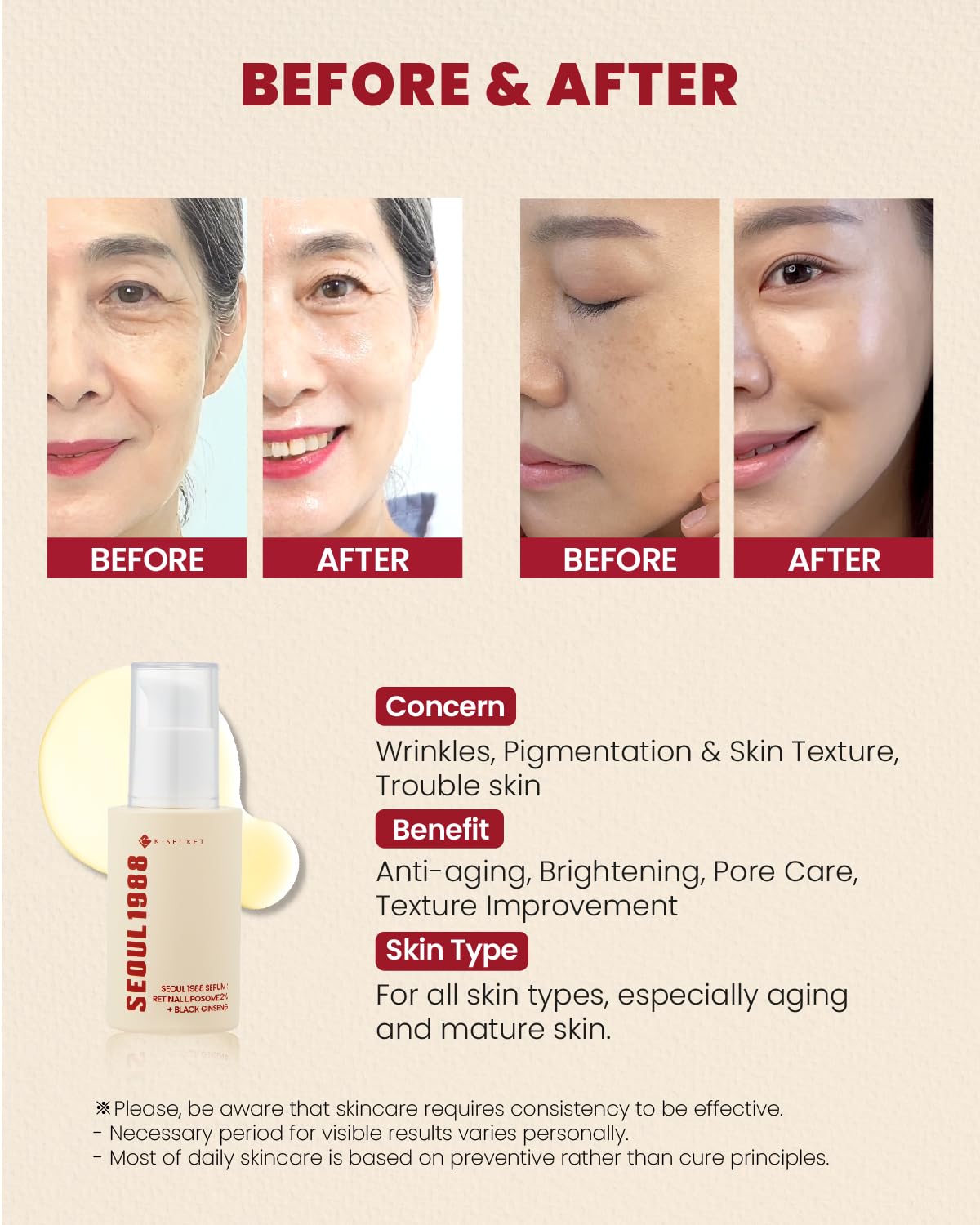 K-SECRET SEOUL 1988 Retinal Serum: 2% Retinal Liposome Black Ginseng Extract Niacinamide Bakuchiol Vitamin C & 3 Peptides for Wrinkle Care Anti Aging - Korean Skincare Fragrance Free Paraben Free Cruelty Free 1 FL OZ